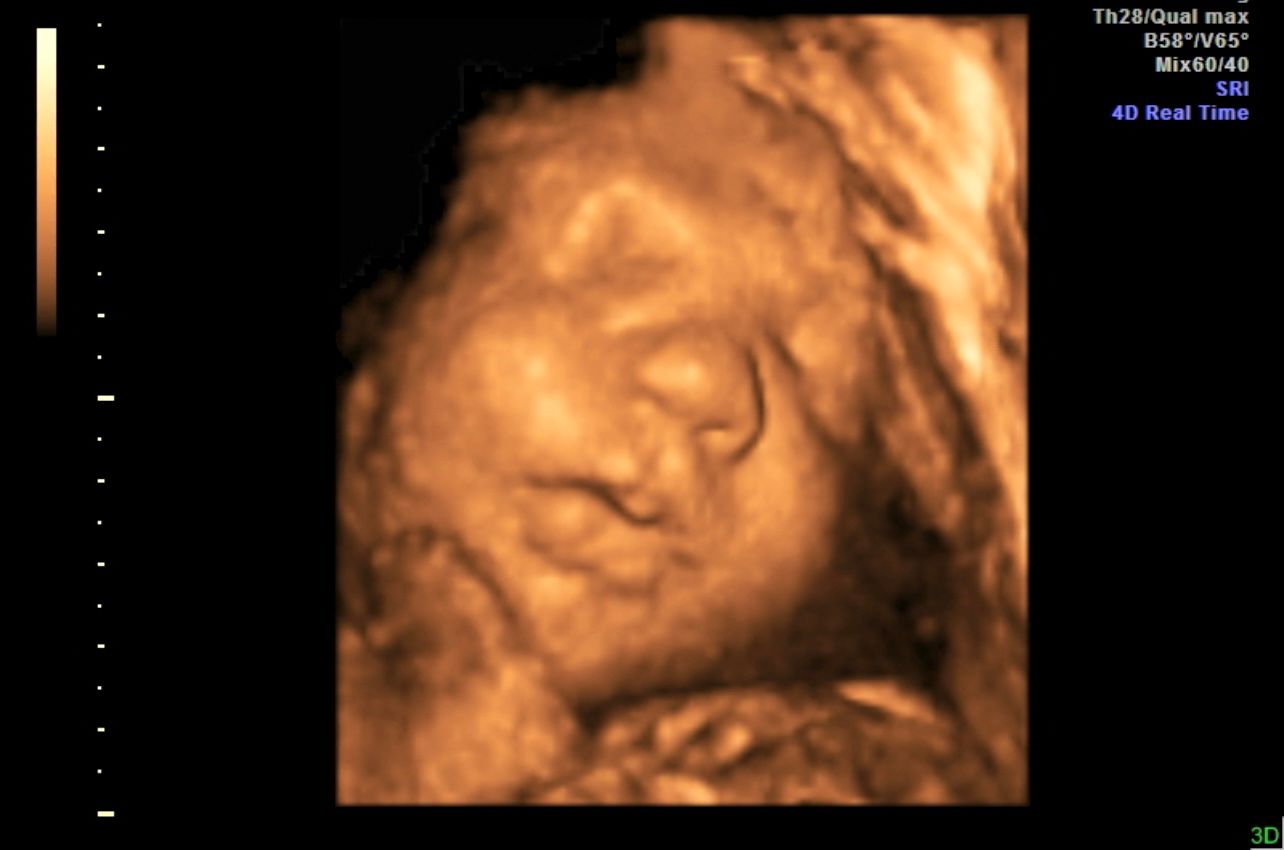 Sepia-toned ultrasound image of a sleeping baby’s face in profile