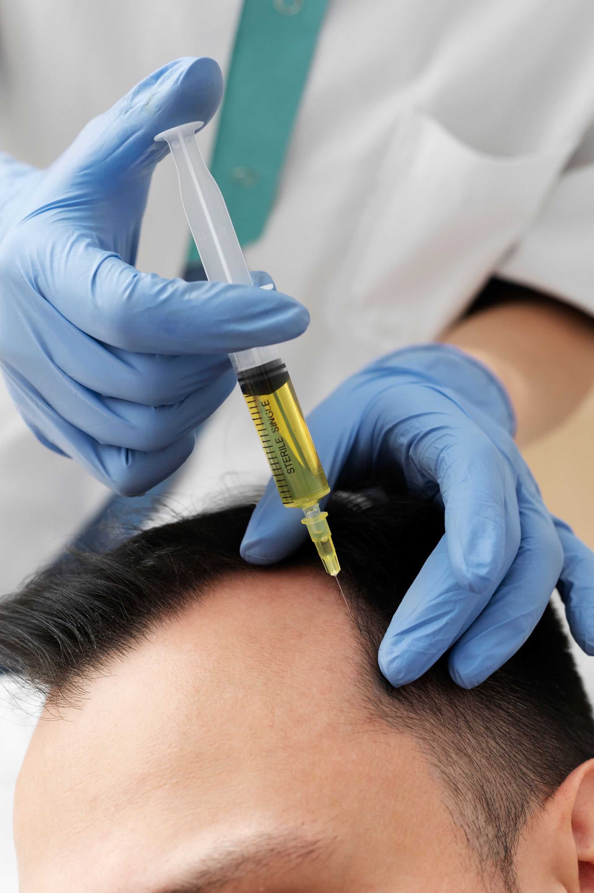 A doctor is giving a man an injection in his head.