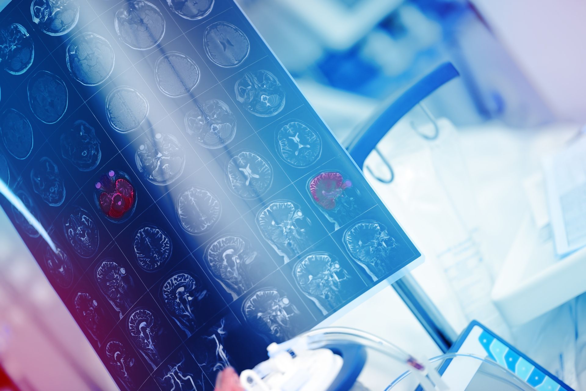 Qual o médico que cuida de tumor cerebral Qual o médico que cuida de tumor cerebral