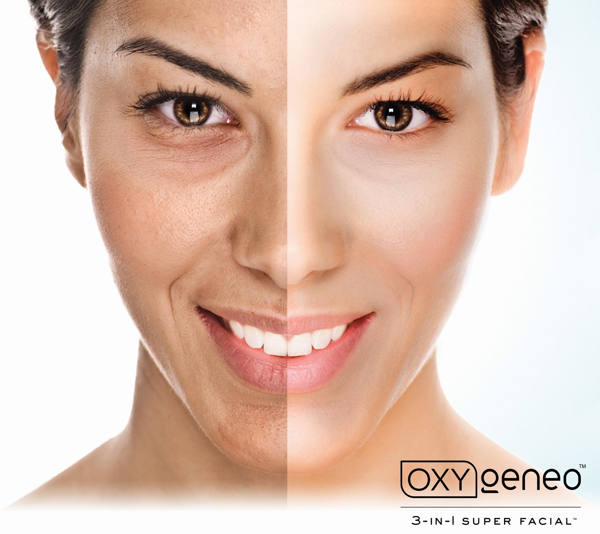Split-face skincare ad showing a woman with one dark, one bright side and an “OXYgeneo” logo.
