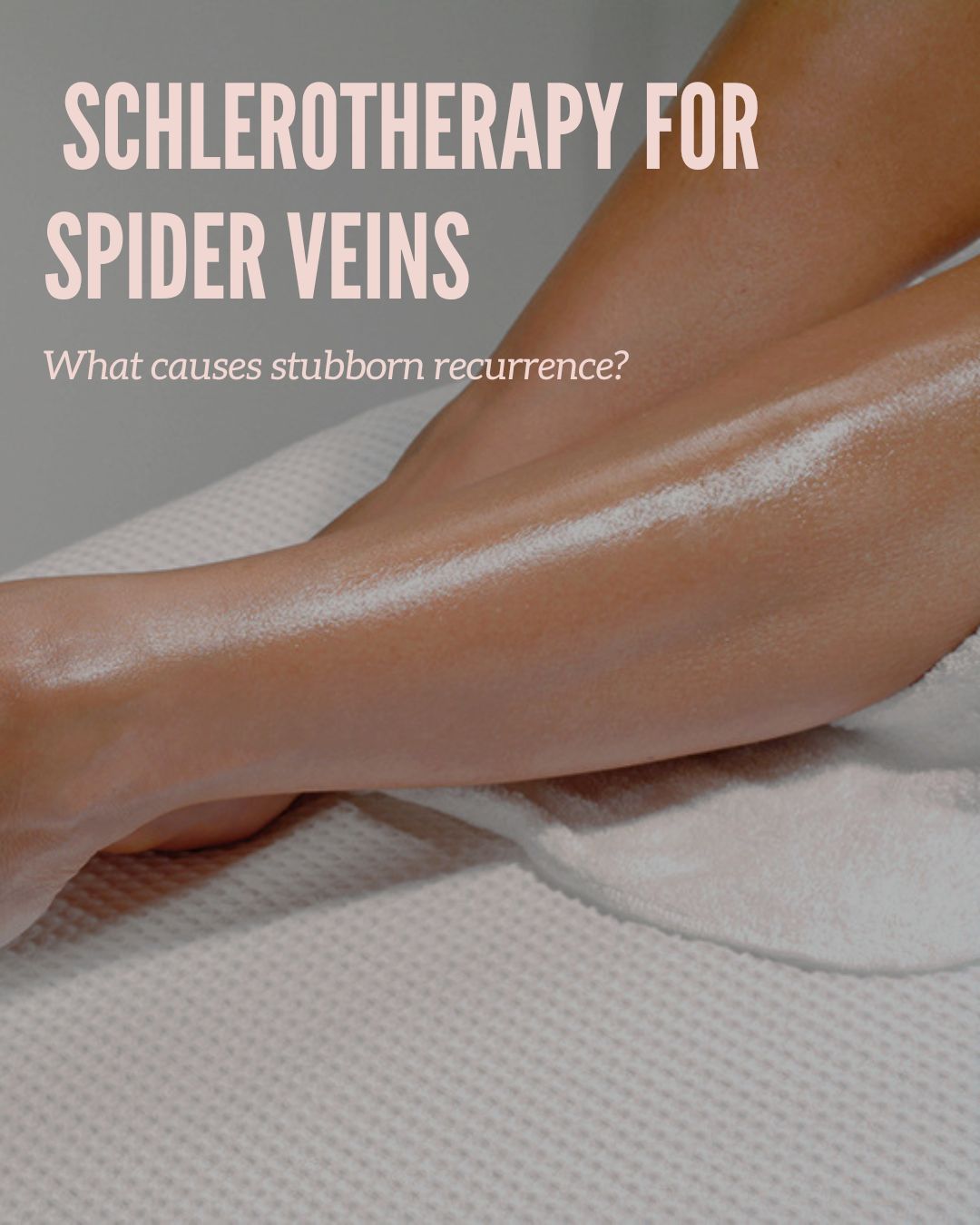 Legs with glossy skin on a towel, overlaid with text: “Sclerotherapy for spider veins”