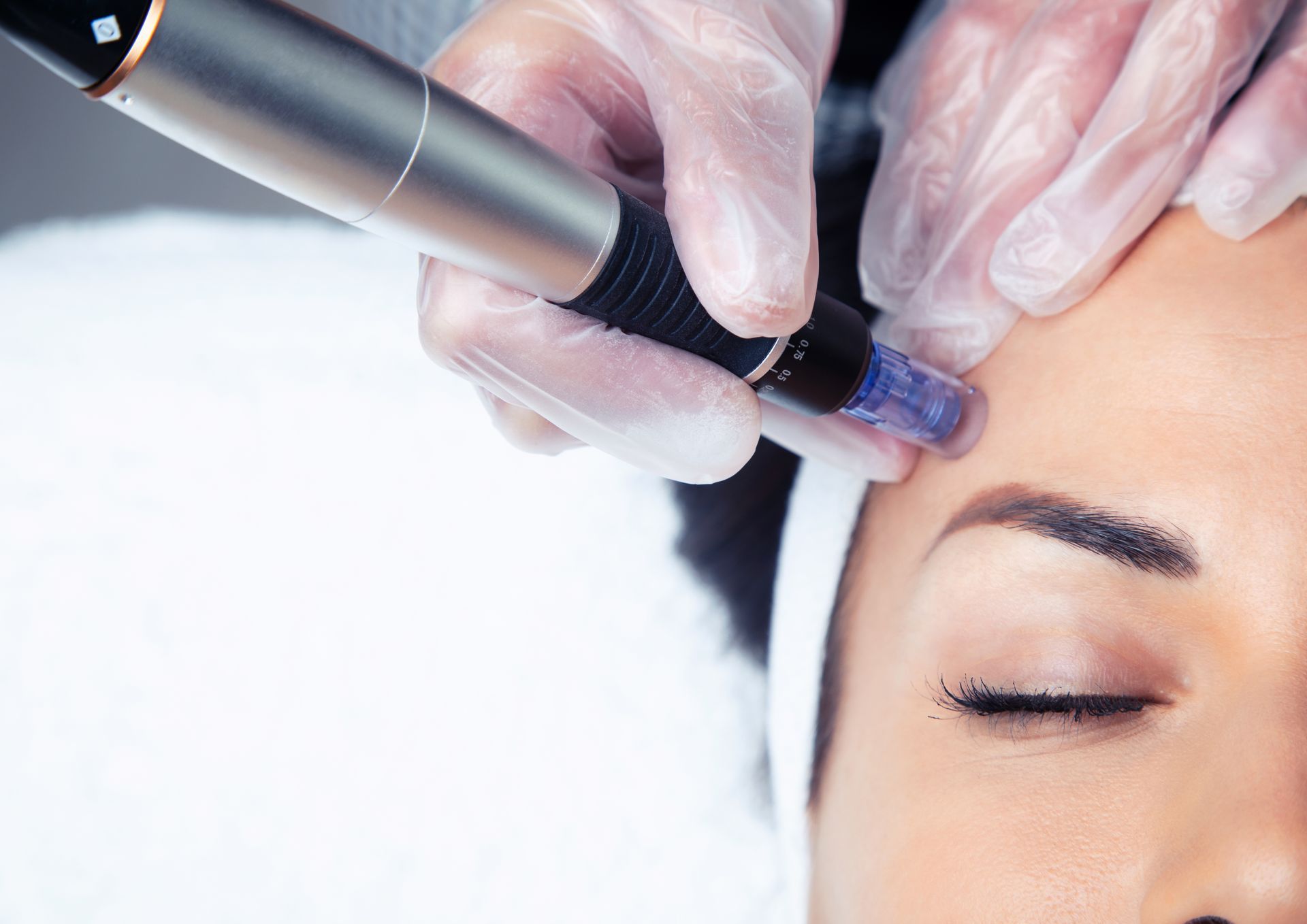 A woman is getting a microneedle treatment on her forehead.