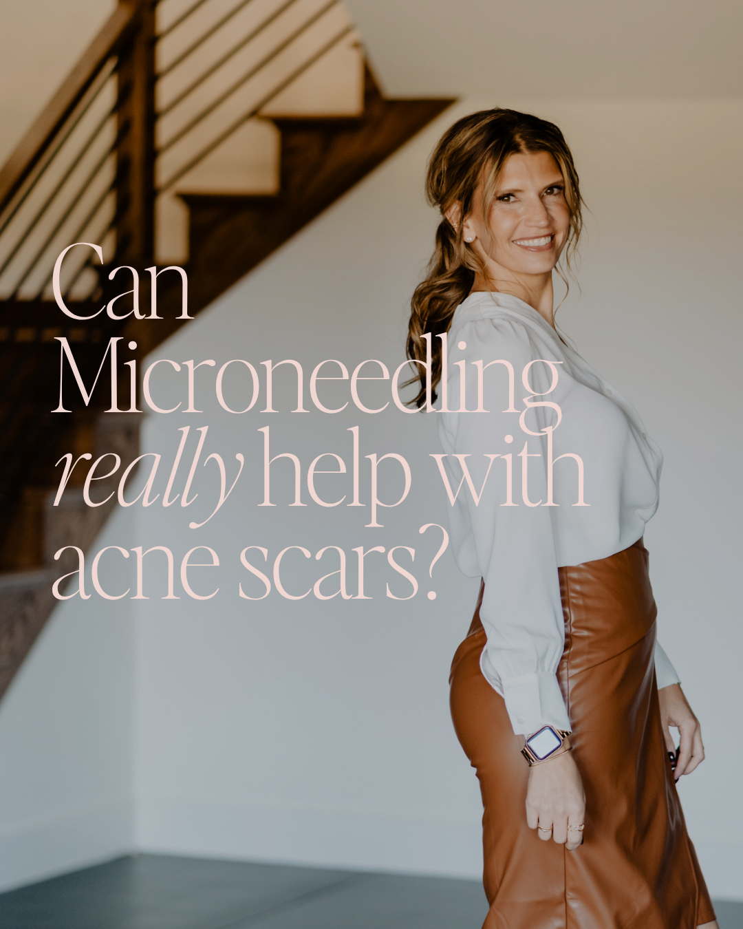 Woman standing indoors on a staircase with overlaid text: “Can Microneedling really help with acne scars?”
