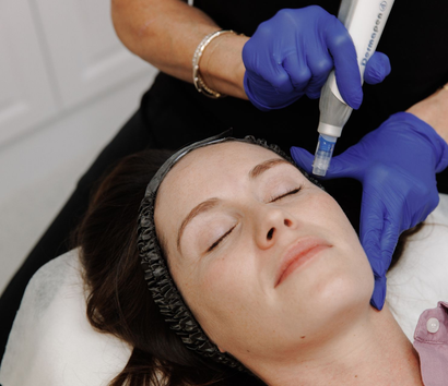 A Woman is Getting a Treatment on Her Face — Renew Laser Clinic in Taree, NSW