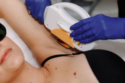 A Woman is Getting a Laser Hair Removal Treatment on Her Legs — Renew Laser Clinic in Taree, NSW