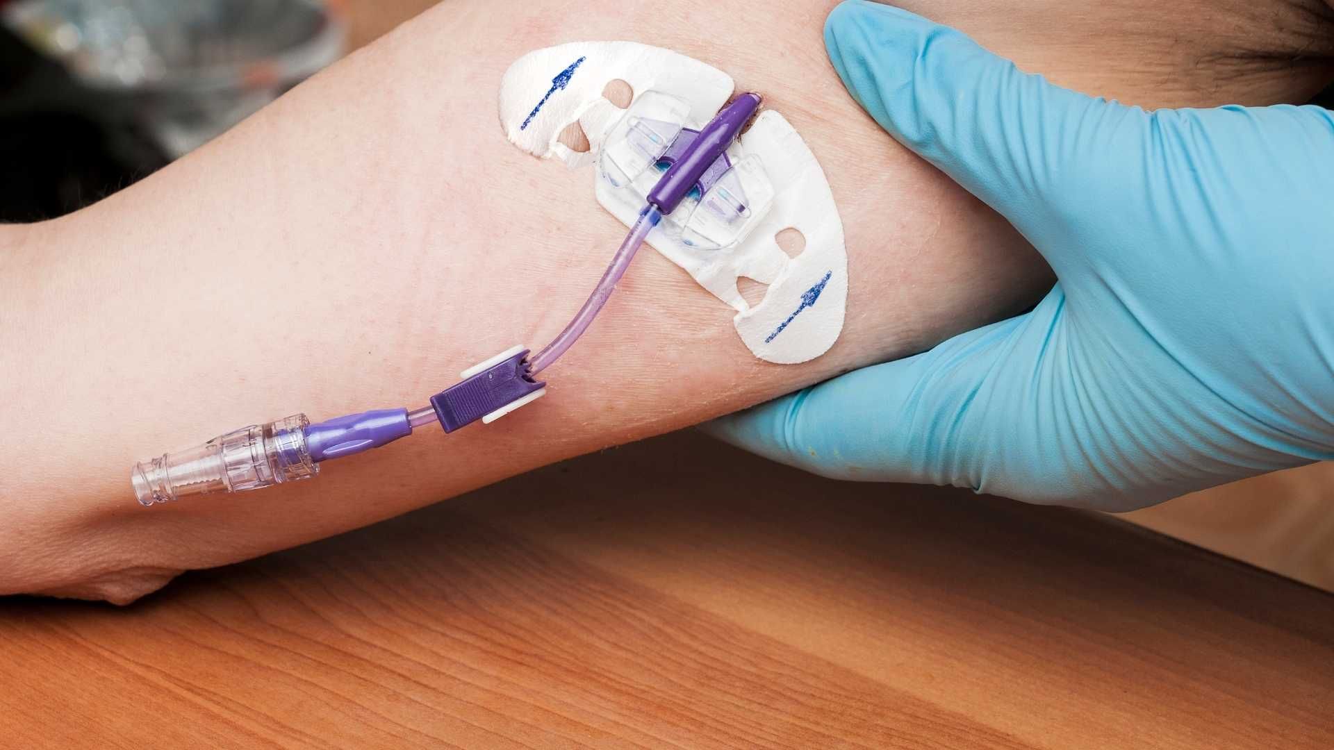 What Is a PICC Line