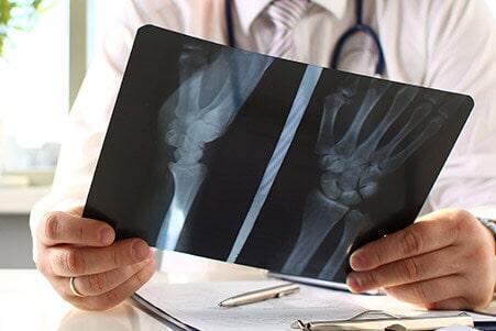 DR. PEDRO ORTIZ LEMUS-ESGUINCES Y FRACTURAS