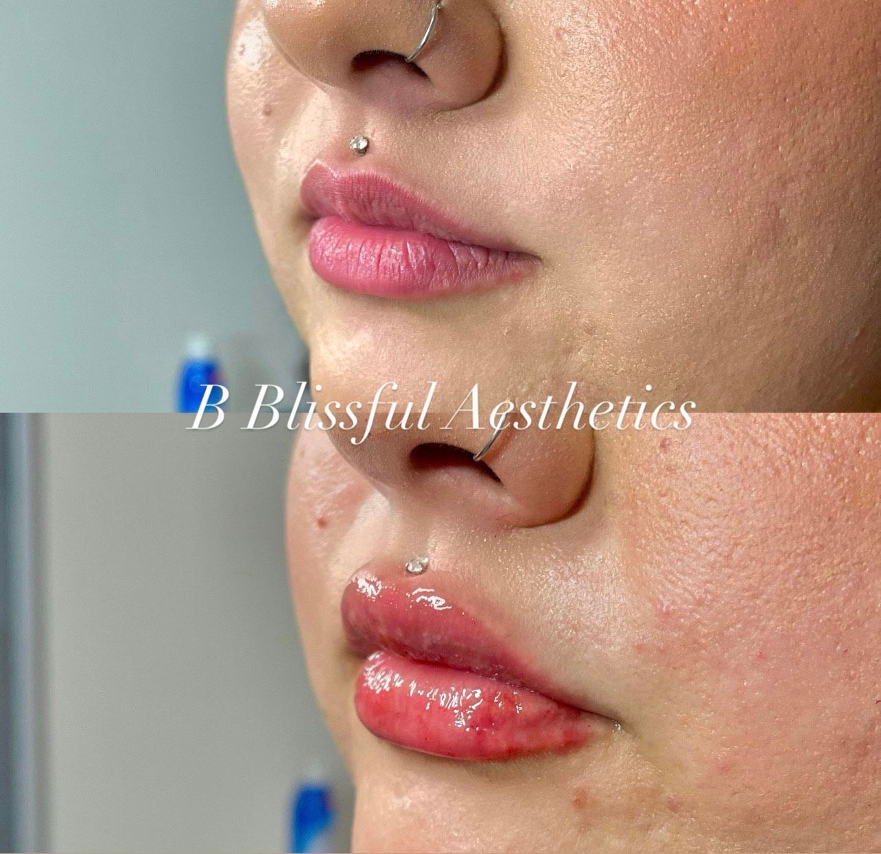 A before and after photo of a woman 's lips with blissful aesthetics written in the corner