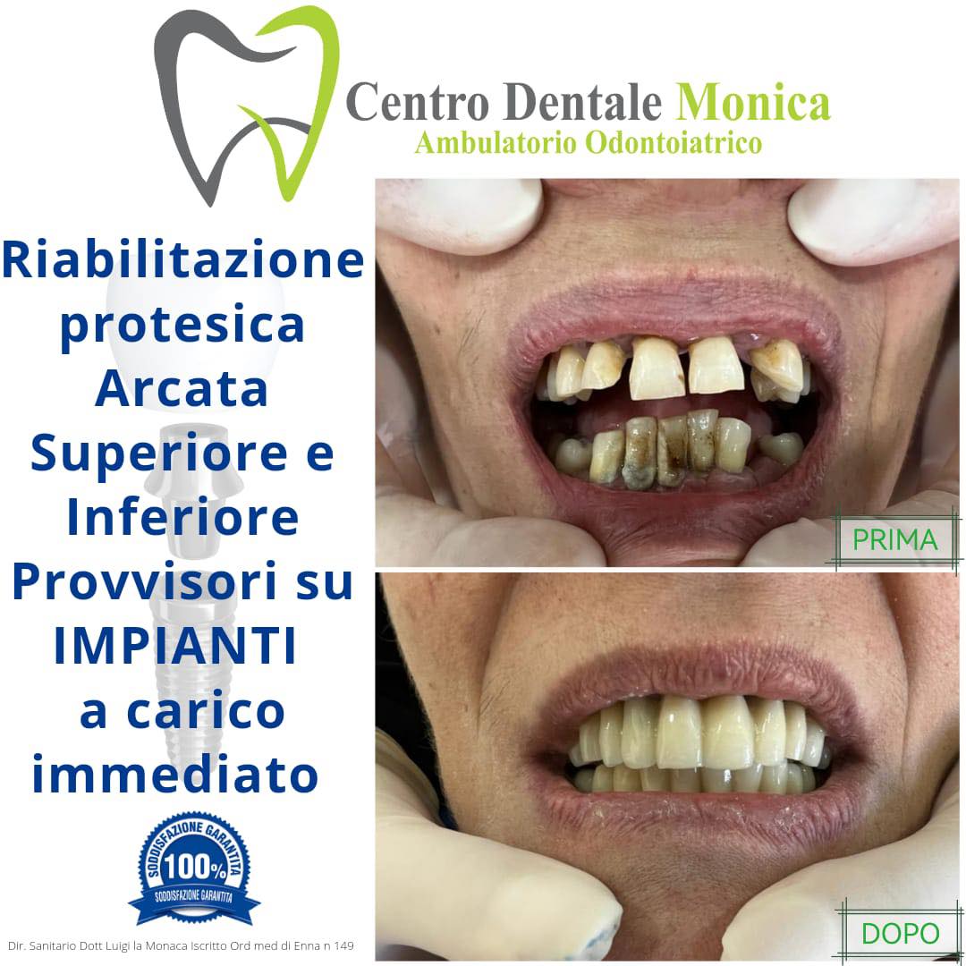 impianti provvisori