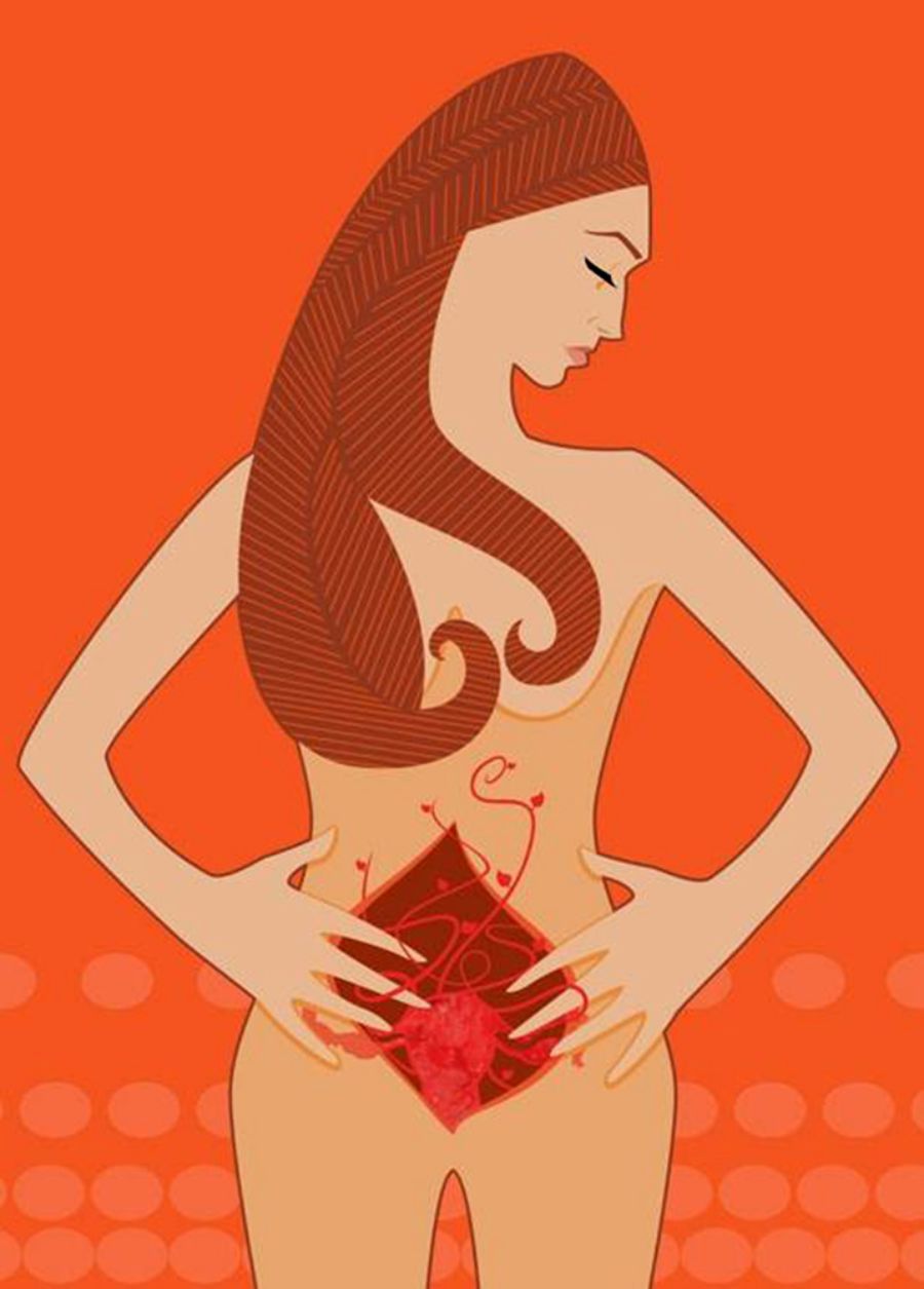 endometriosi