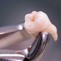 Chirurgie orale Chirurgie orale