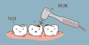 animated drilling  - Lincoln, NE - Blome Family Dentistry