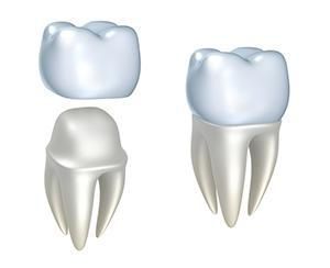 two teeth - Lincoln, NE - Blome Family Dentistry two teeth - Lincoln, NE - Blome Family Dentistry