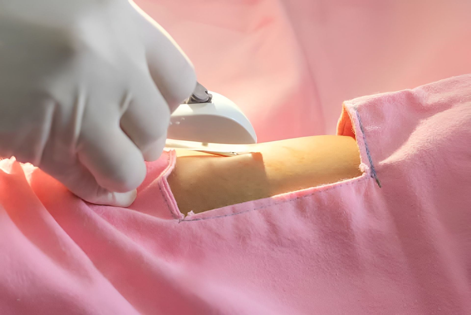 A Doctor's Hand Doing An Operation On Patient's Skin — Mall Medical Centre In Alice Springs, NT
