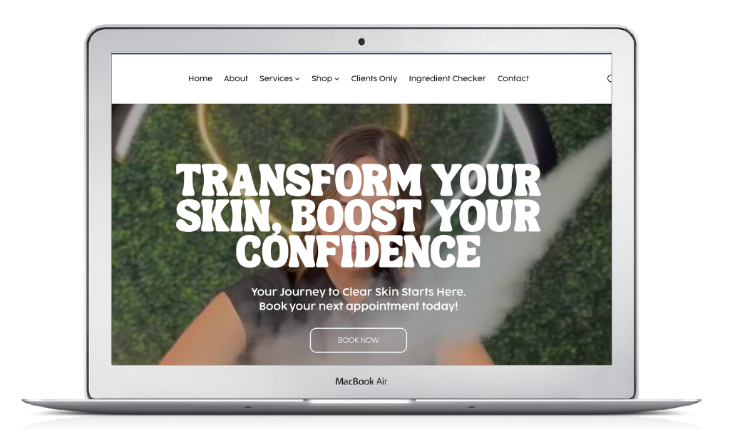A laptop is open to a page that says transform your skin boost your confidence kyraskin med spa