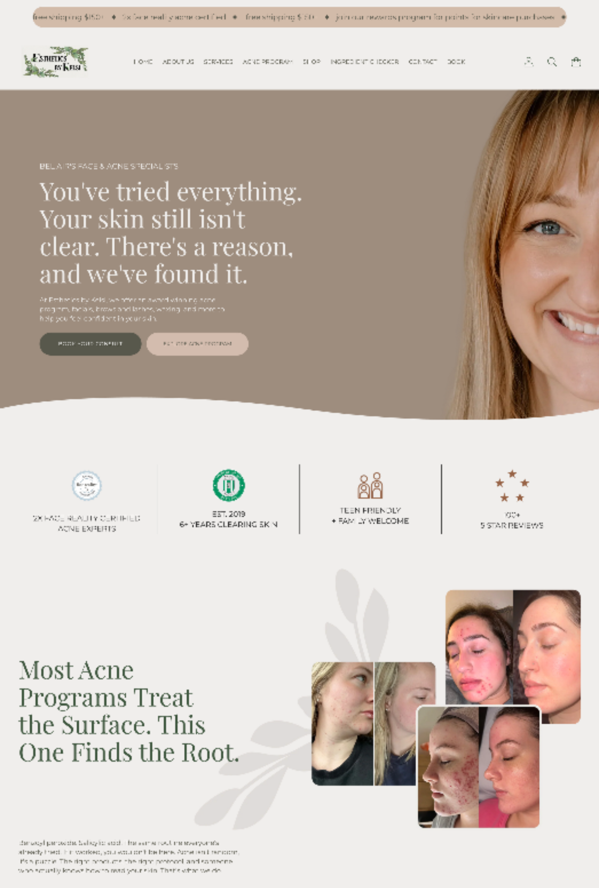 Website homepage for a beauty clinic, with a woman’s face, beige branding, and treatment options icons