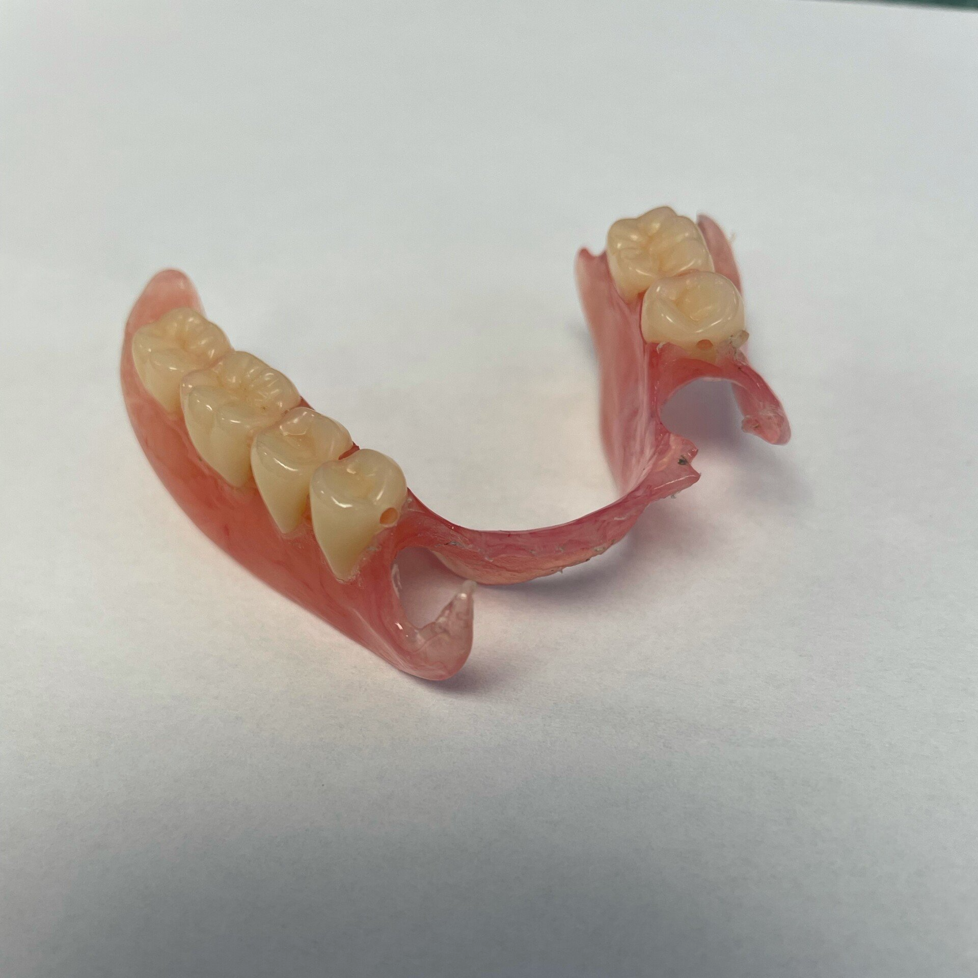 Partial Dentures | Woodbridge, Ontario | Sommer Denture