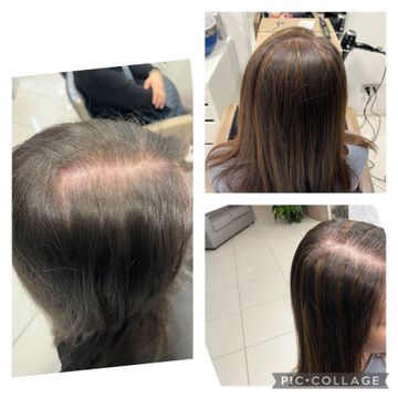 acconciatura trecce