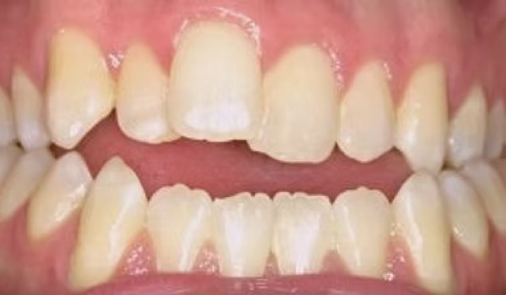 Braces Doc Before and After