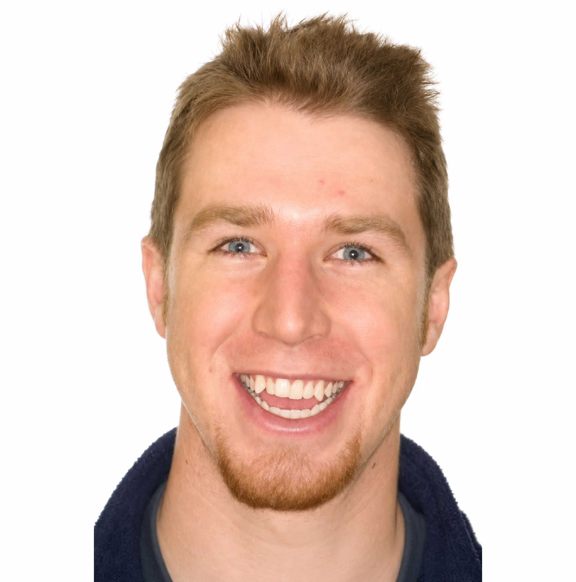 Braces Doc Before and After