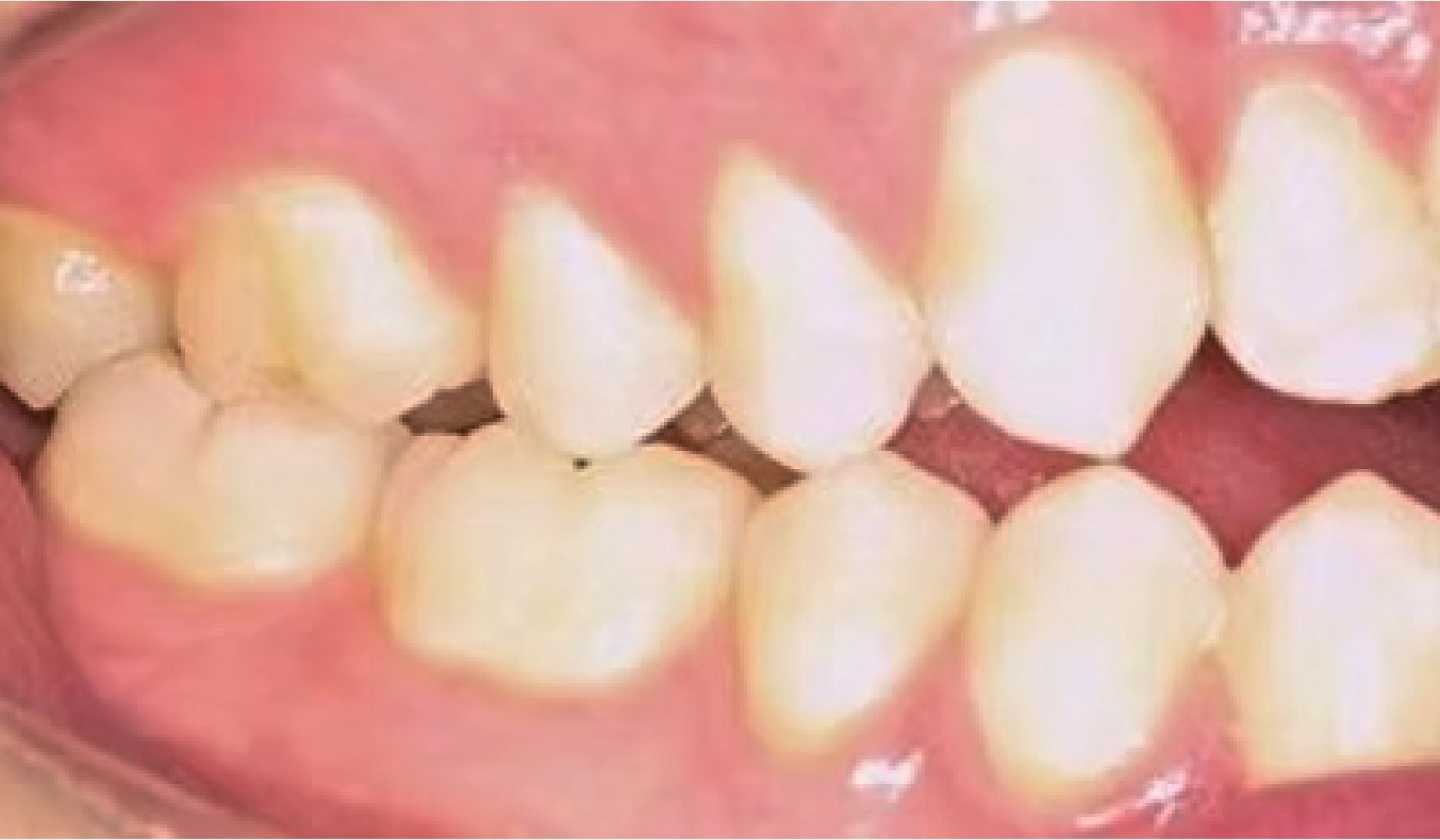 Braces Doc Before and After
