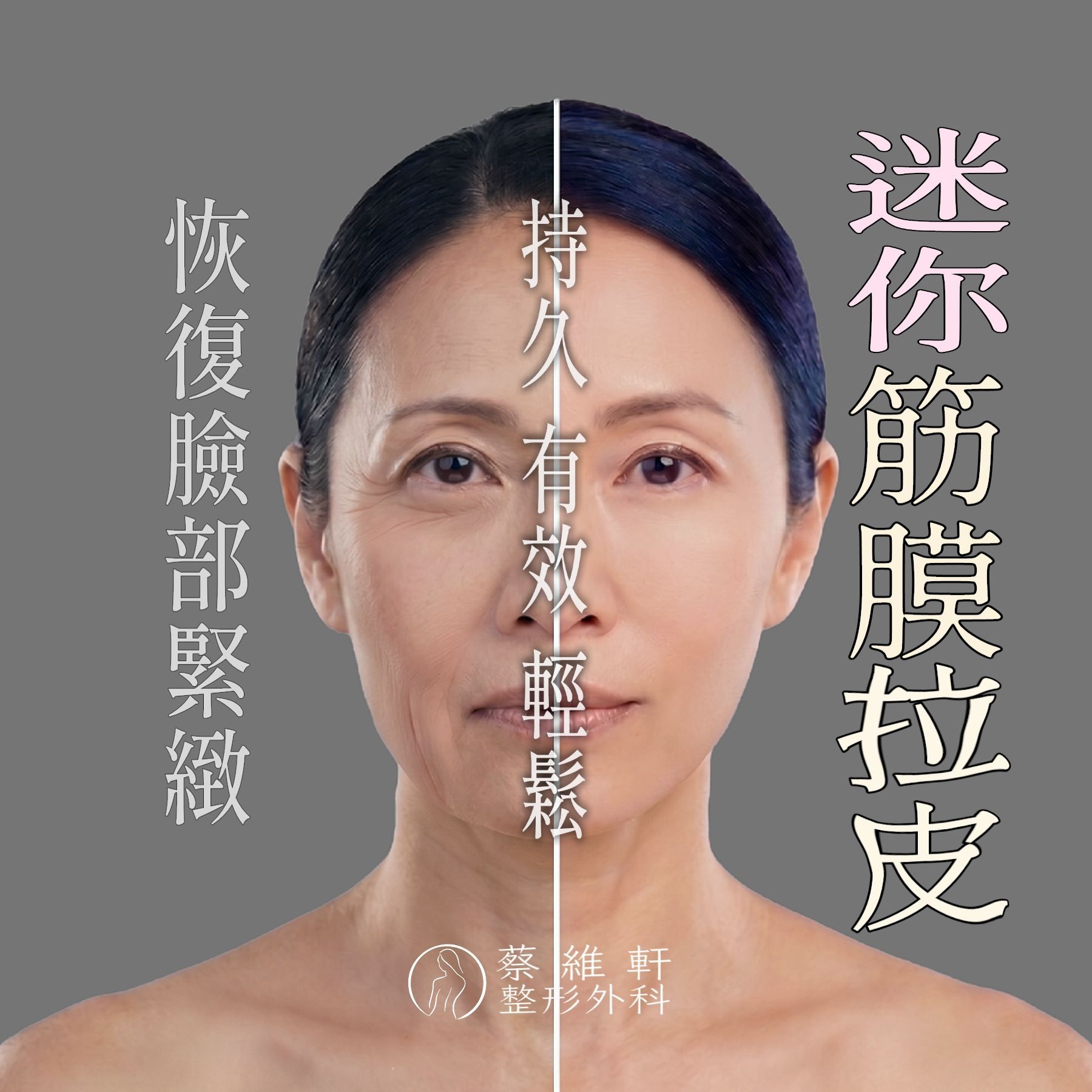 迷你筋膜拉迷MACS lift