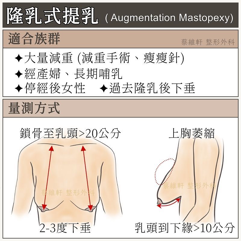 隆乳式提乳手術,治療乳房萎縮(體積縮小)與下垂(高度下降)。適合大量減重(減重手術、瘦瘦針)、經產婦、長期哺乳、停經後女性、過去隆乳後再次下垂等族群。