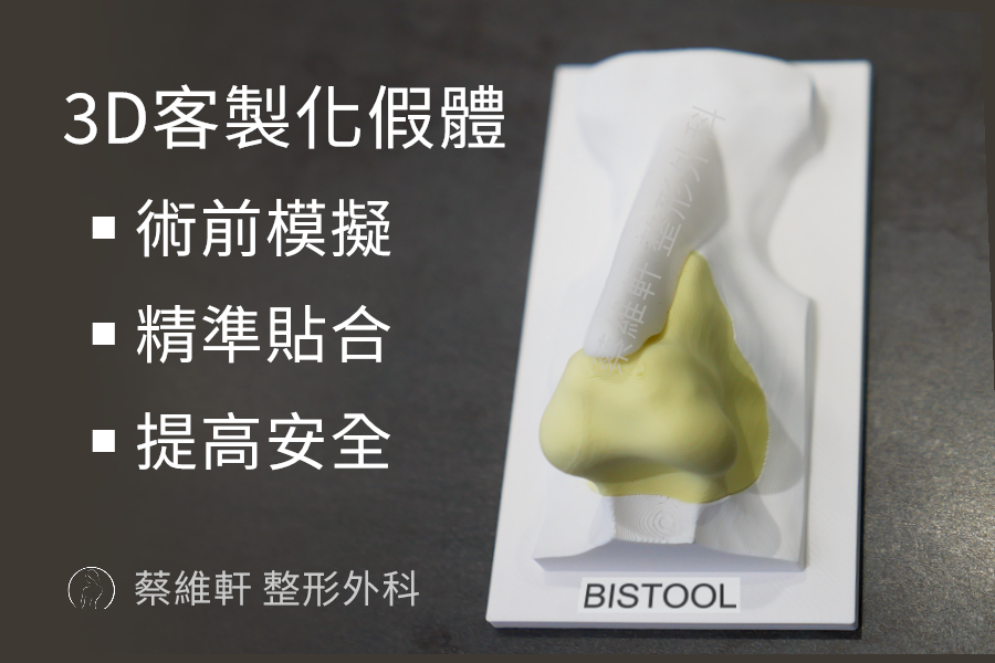 3D列印假體,能夠做到精準的術前模擬、極度貼合人體,Fitme完型美、Sofit、uniplan優尼美