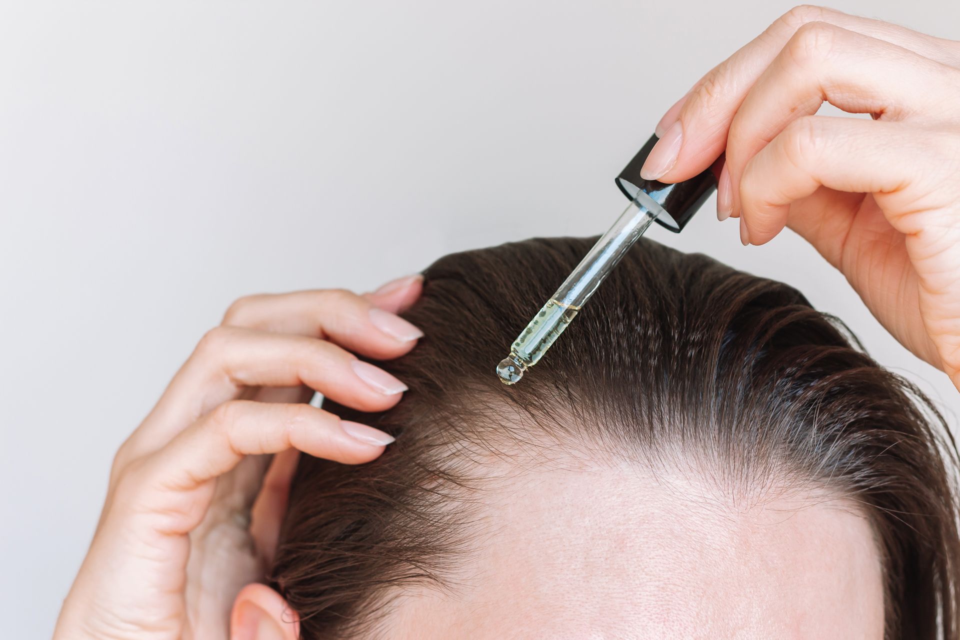Women’s hair loss treatment with scalp serum dropper applied to thinning hairline area.