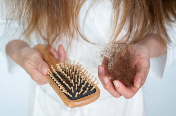 Hair loss it cause from family history, hormonal changes, unhealthy of aging
