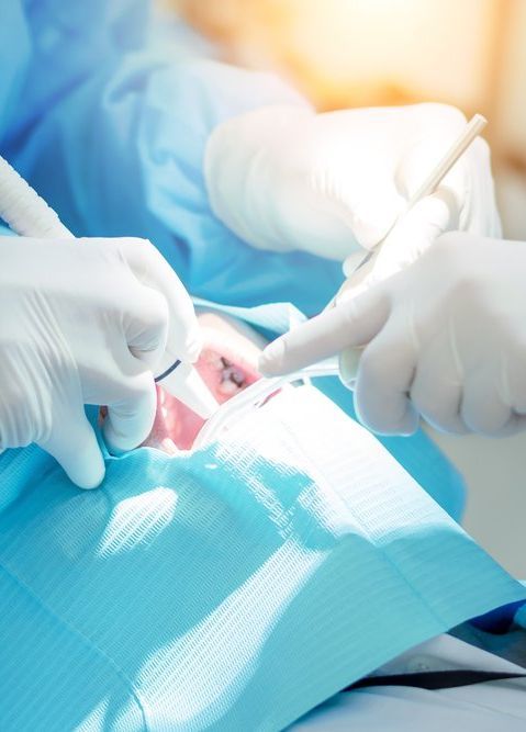 Un dentiste travaille sur les dents d'un patient dans un cabinet dentaire.