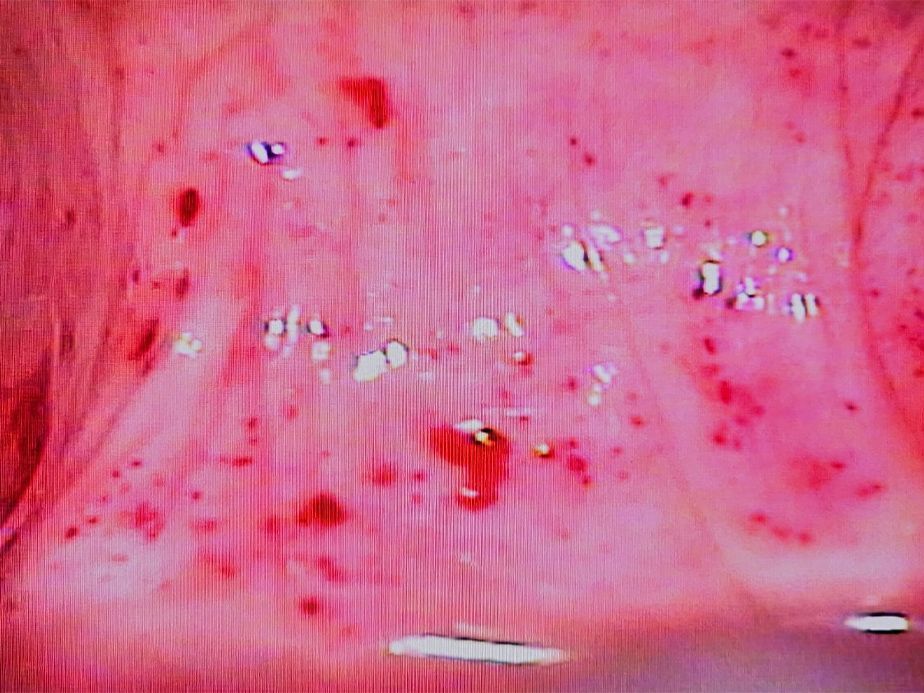 CLINICA DE DISPLASIAS LASER CIRUGIA S.C - enfermedades sexuales