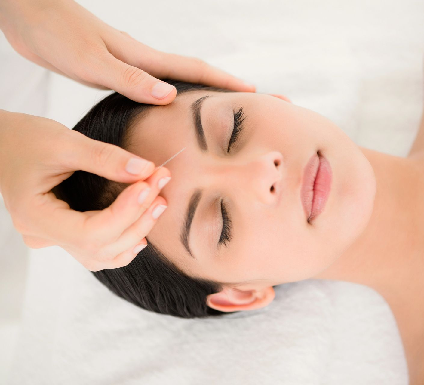 Facial Rejuvenation Acupuncture in Westbury, NY Facial Rejuvenation Acupuncture in Westbury, NY