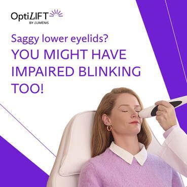 Optilift