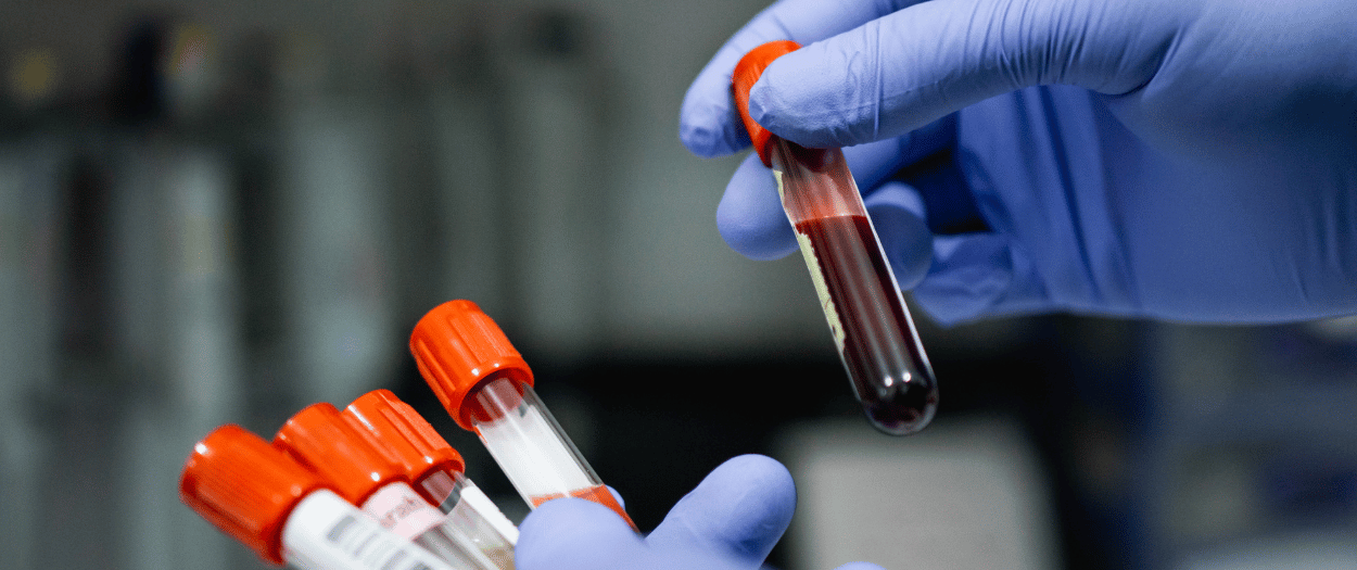 Labs