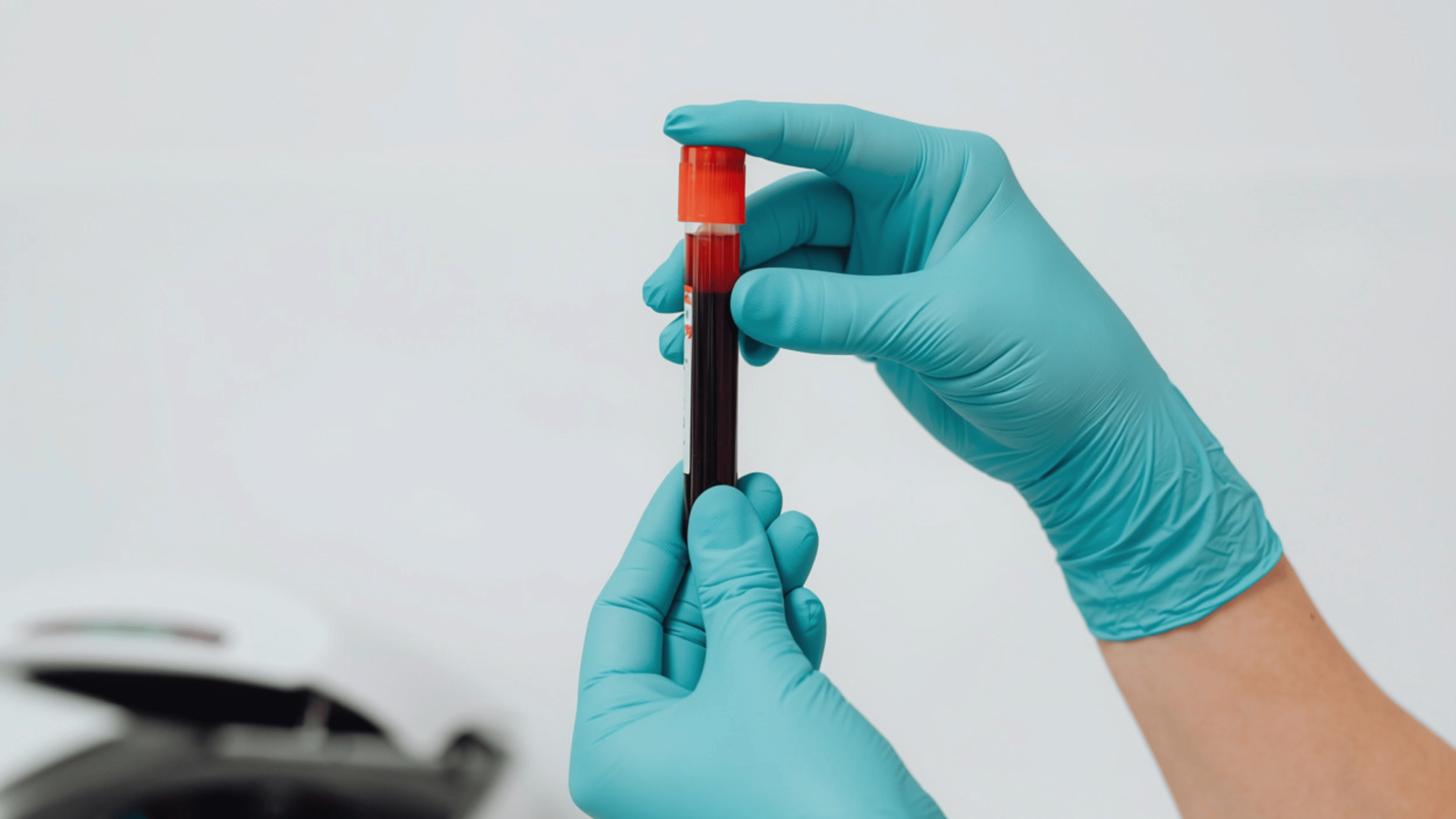 New lab included in Knew Health Membership: Thyroid + TSH panel