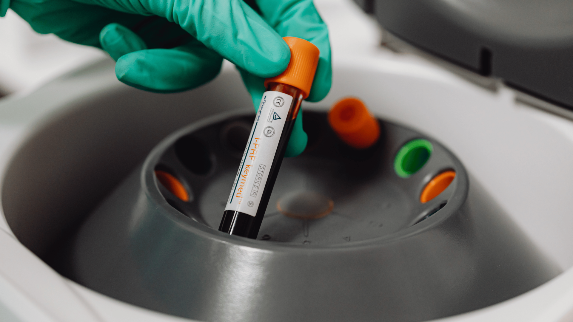 Blood sample being added into a centrifuge for testing