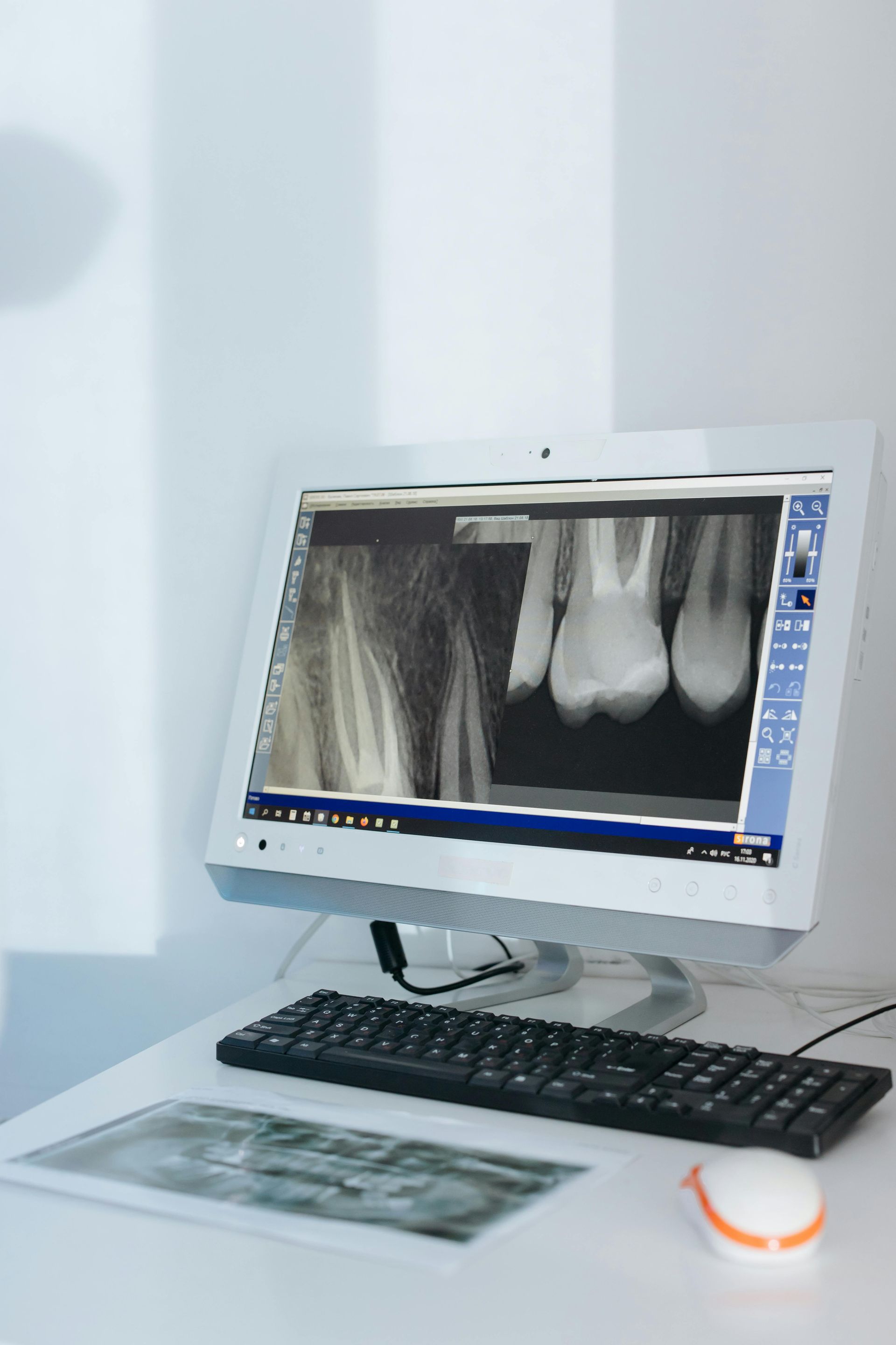 Radiografia dentária exibida em um monitor de computador, com teclado, mouse e radiografia impressa sobre uma mesa branca.