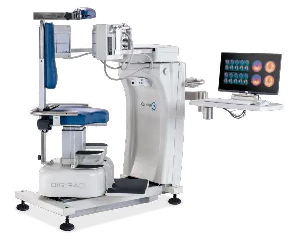 Medical device for breast imaging; white and blue; monitor displays scan images.