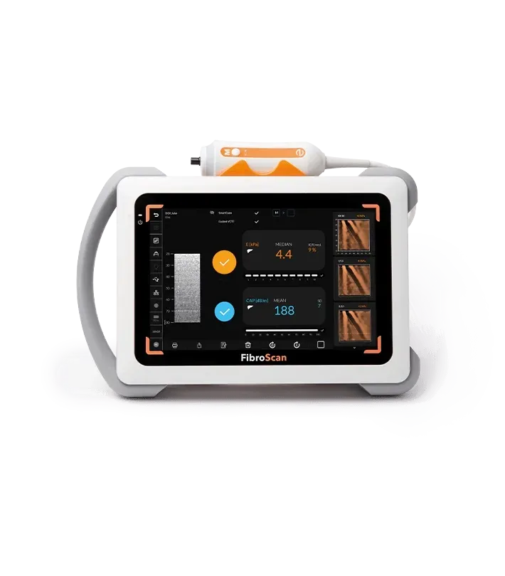 FibroScan