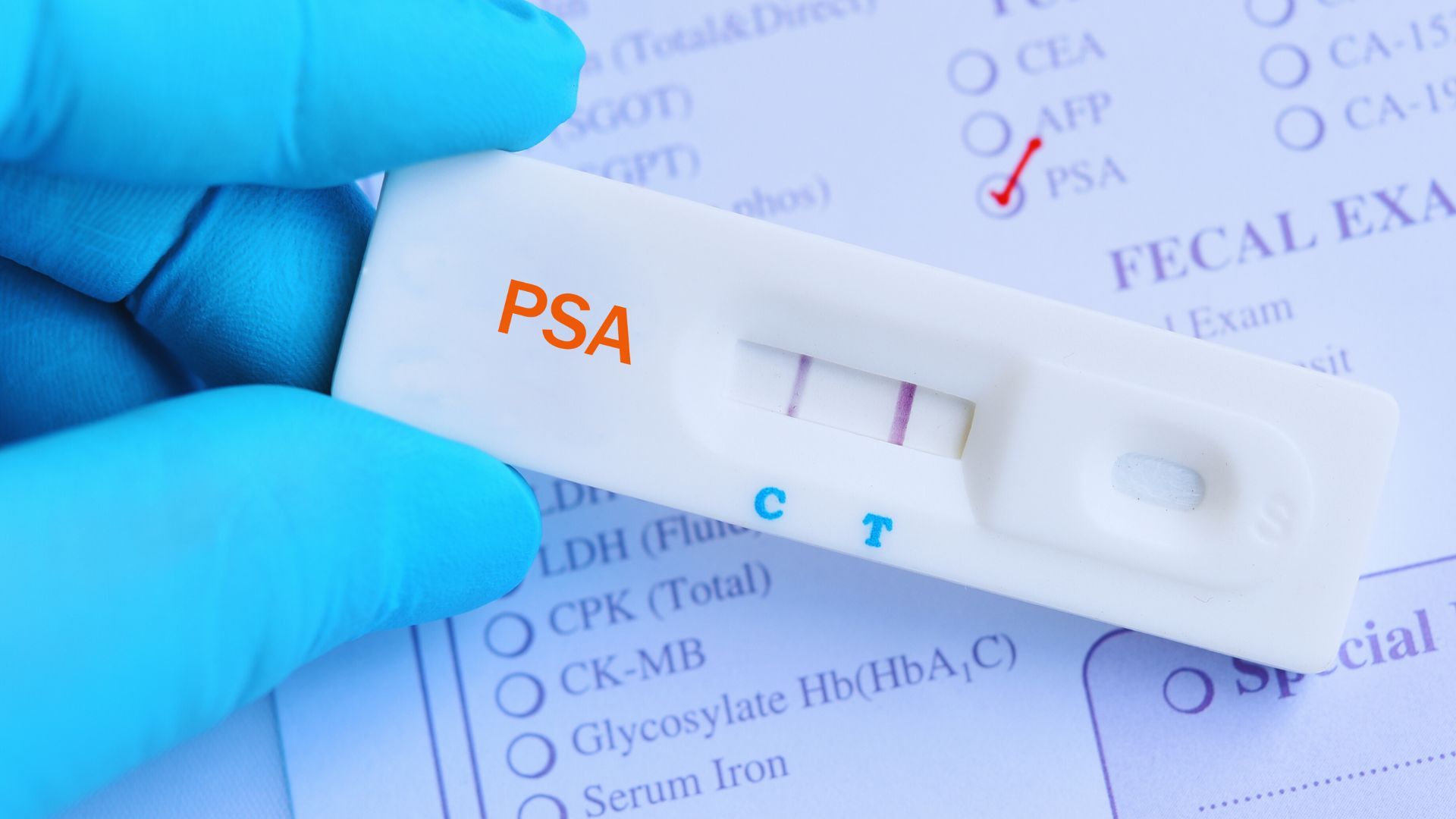 Una persona tiene in mano un test del PSA.