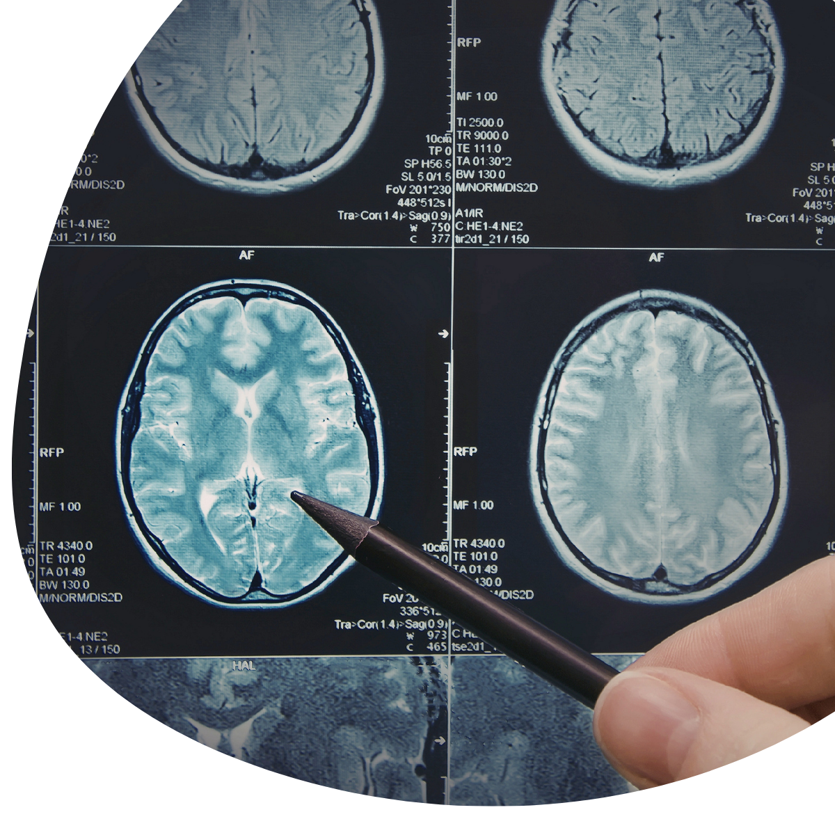 Technician and patient beside an MRI scanner in a medical imaging room