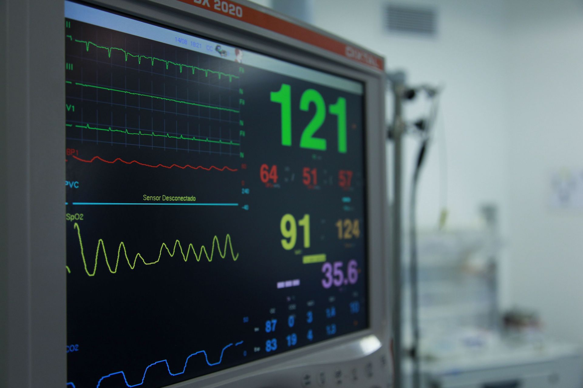 Hospital monitor displaying vital signs with green and yellow heart-rate graphs and large numeric readings