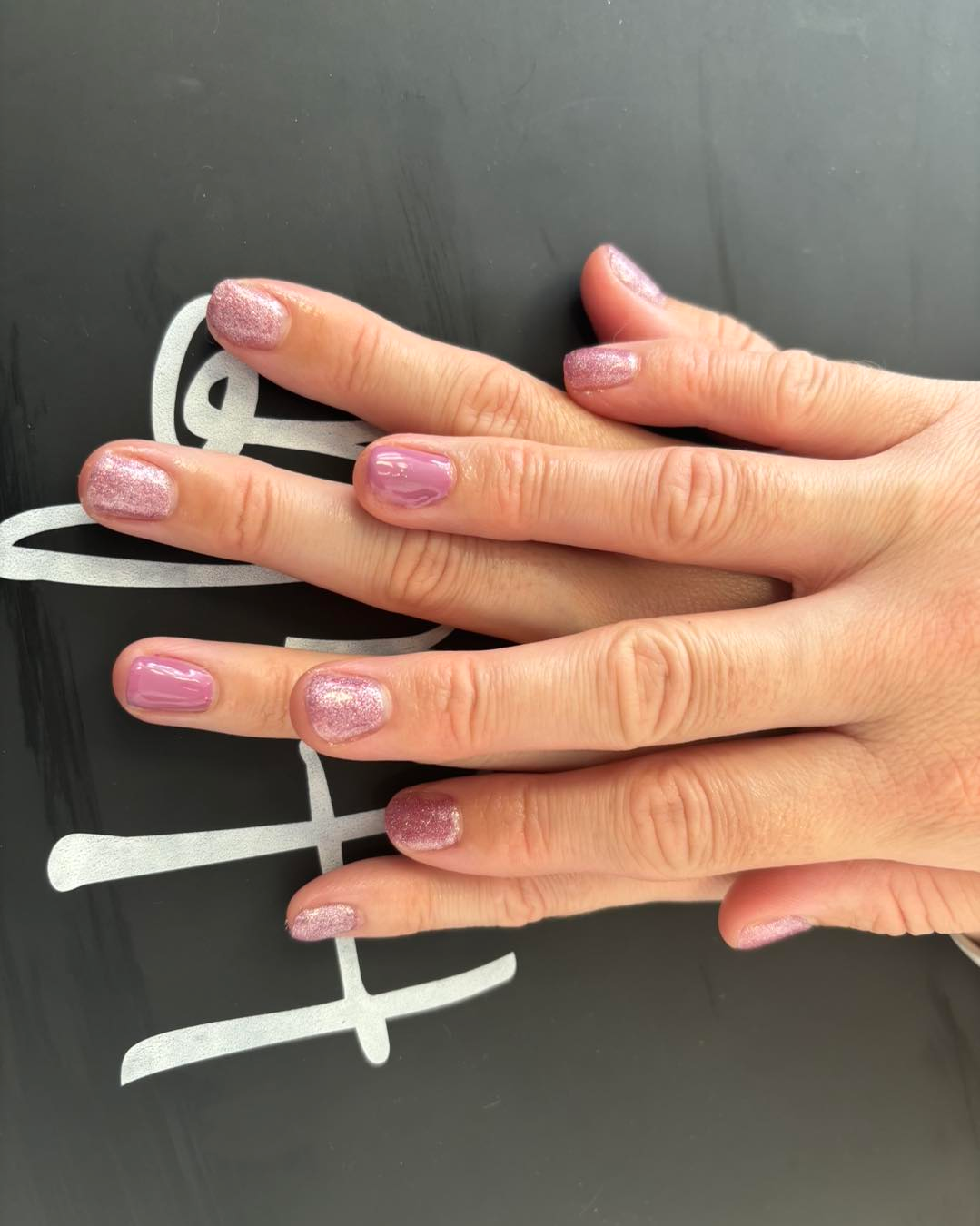 A close-up of two hands resting on a dark surface, featuring alternating pink glittery and solid pink manicured nails.