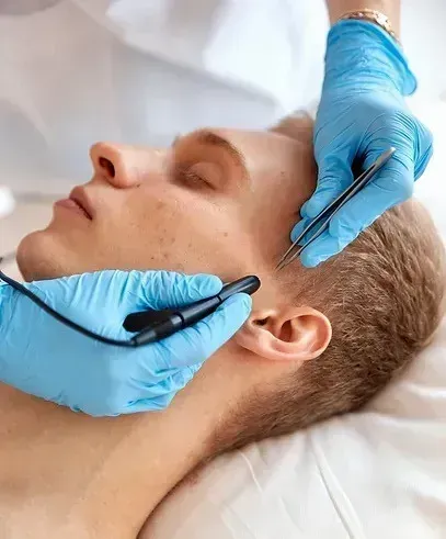 Gloved hands use a precision tool on a man's chin during a facial skin treatment