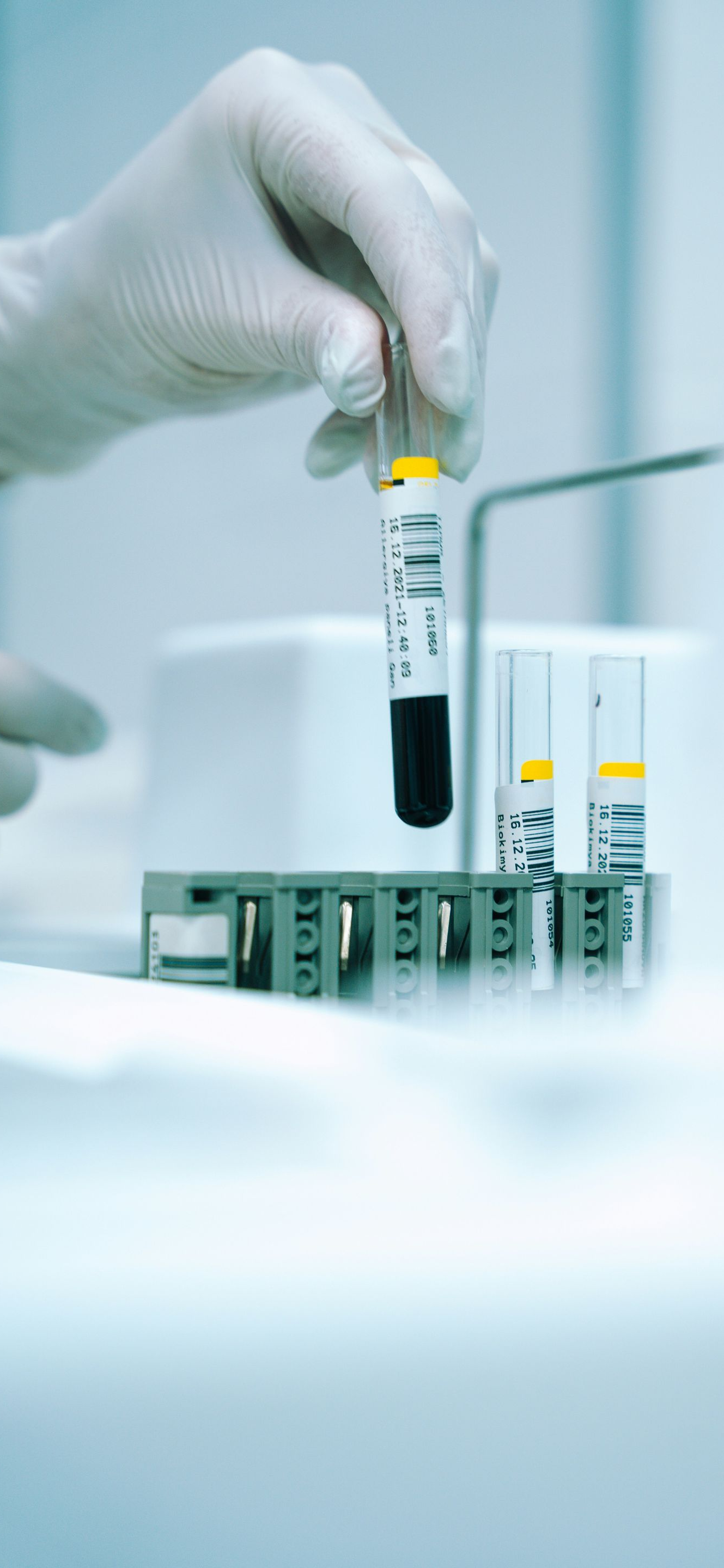 Gloved hand placing a test tube in a lab rack with other sample tubes