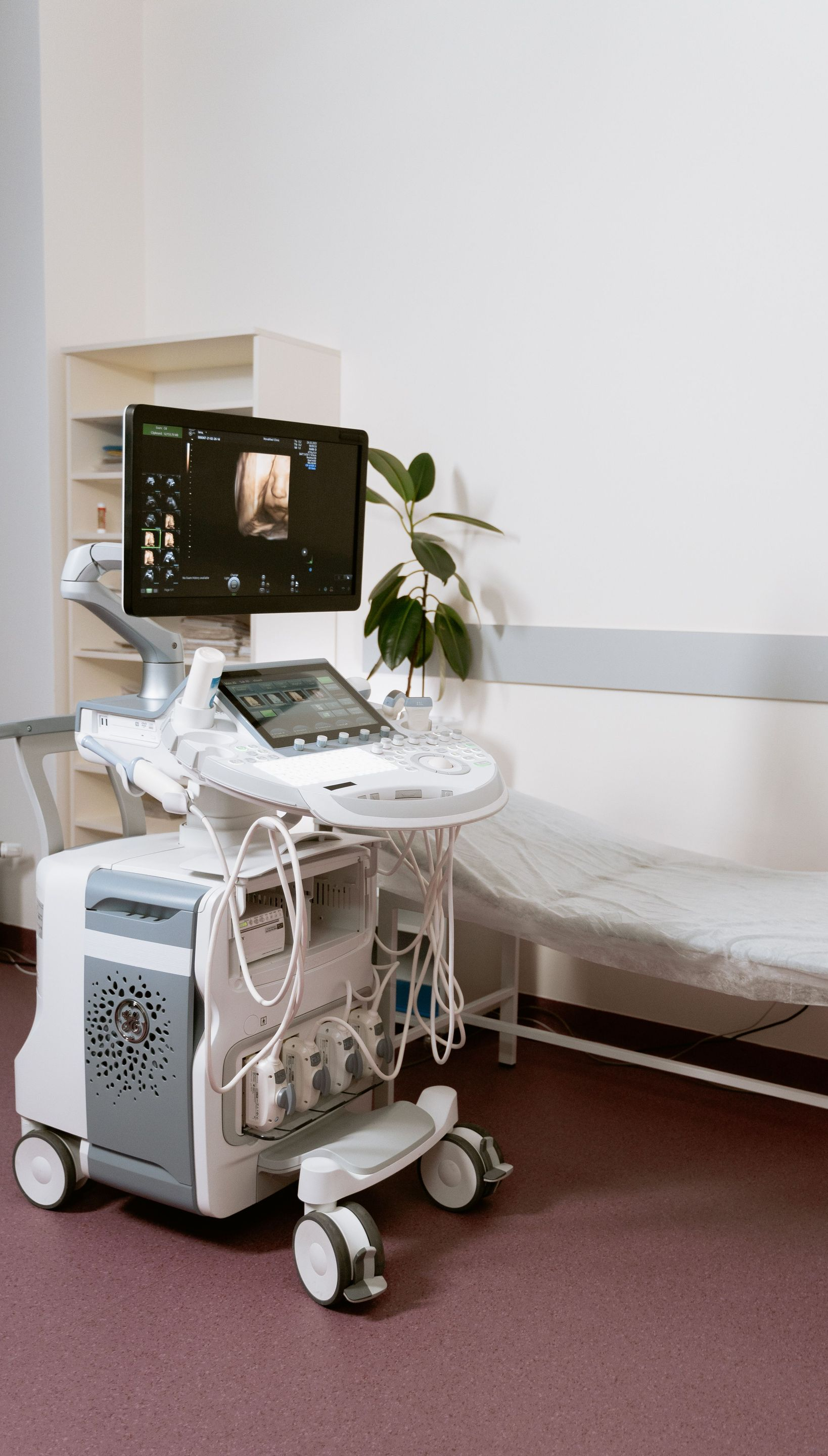 Medical ultrasound machine beside a hospital bed in a clinical room