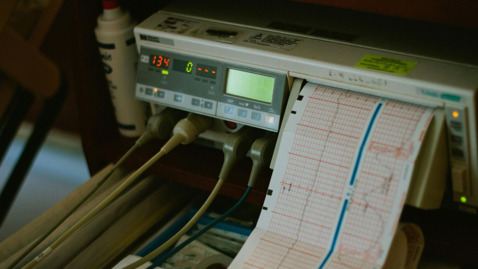 Fetal monitoring machine displaying waveforms on paper; medical equipment with cables and a digital display.