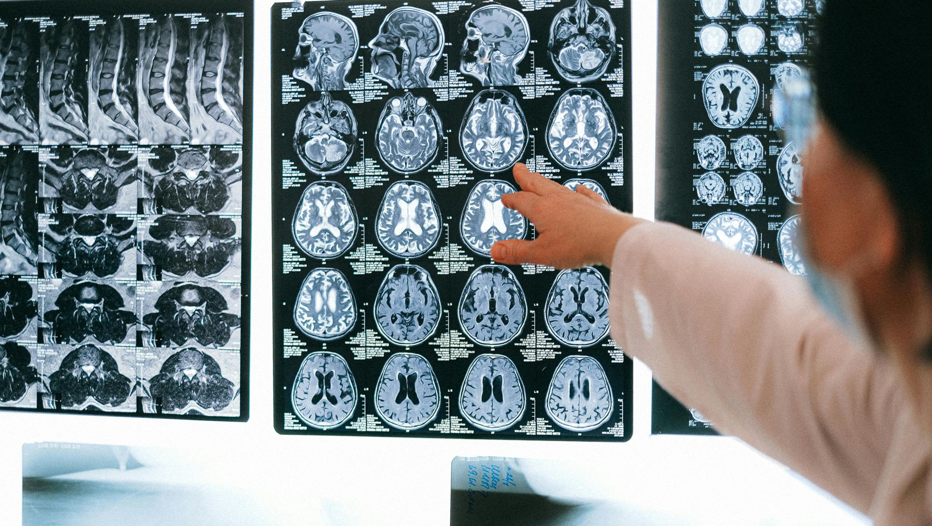 Doctor pointing to brain scans, with bone X-rays visible below.