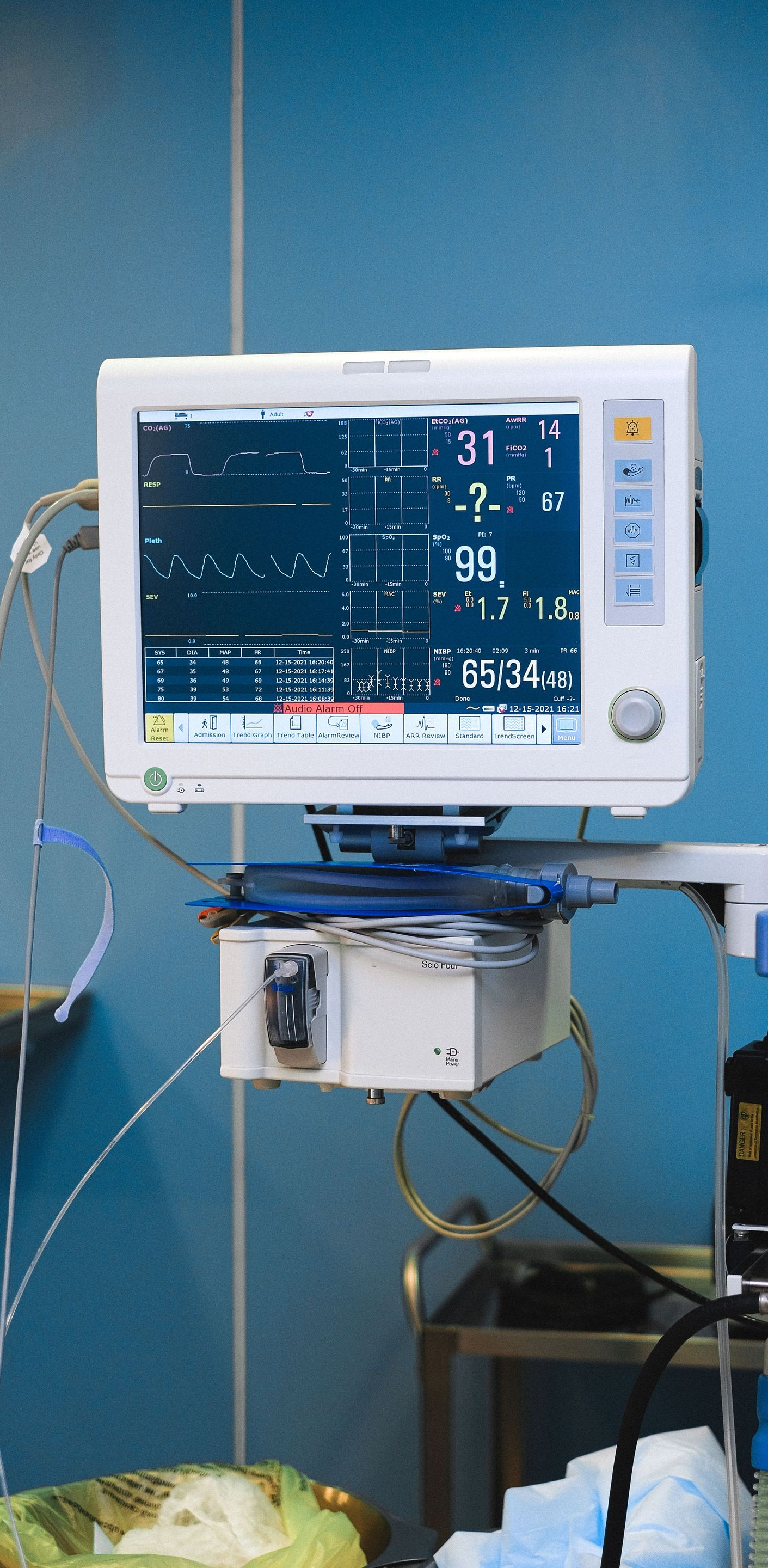Hospital bedside monitor showing vital signs on a blue wall with cables and equipment below.